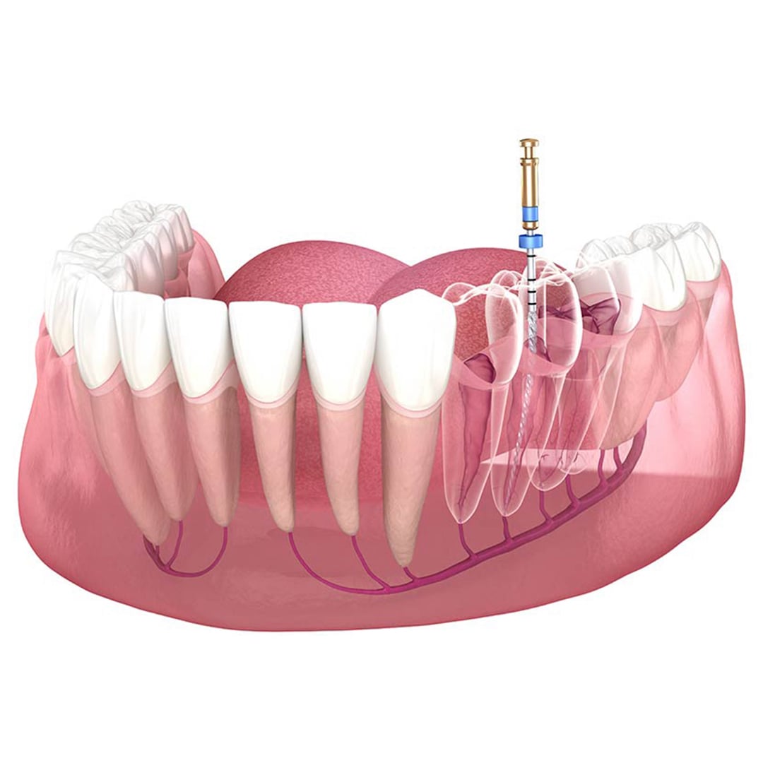 Dr Mozo endodoncias