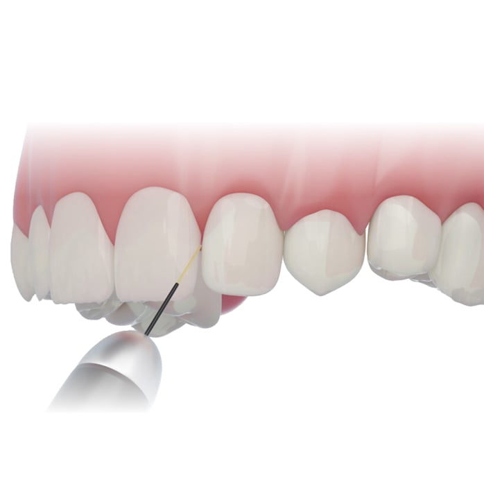 Dr Mozo biopsy